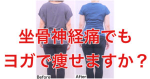 坐骨神経痛でもダイエットヨガで痩せられますか？